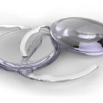Cost of Cataract Surgery