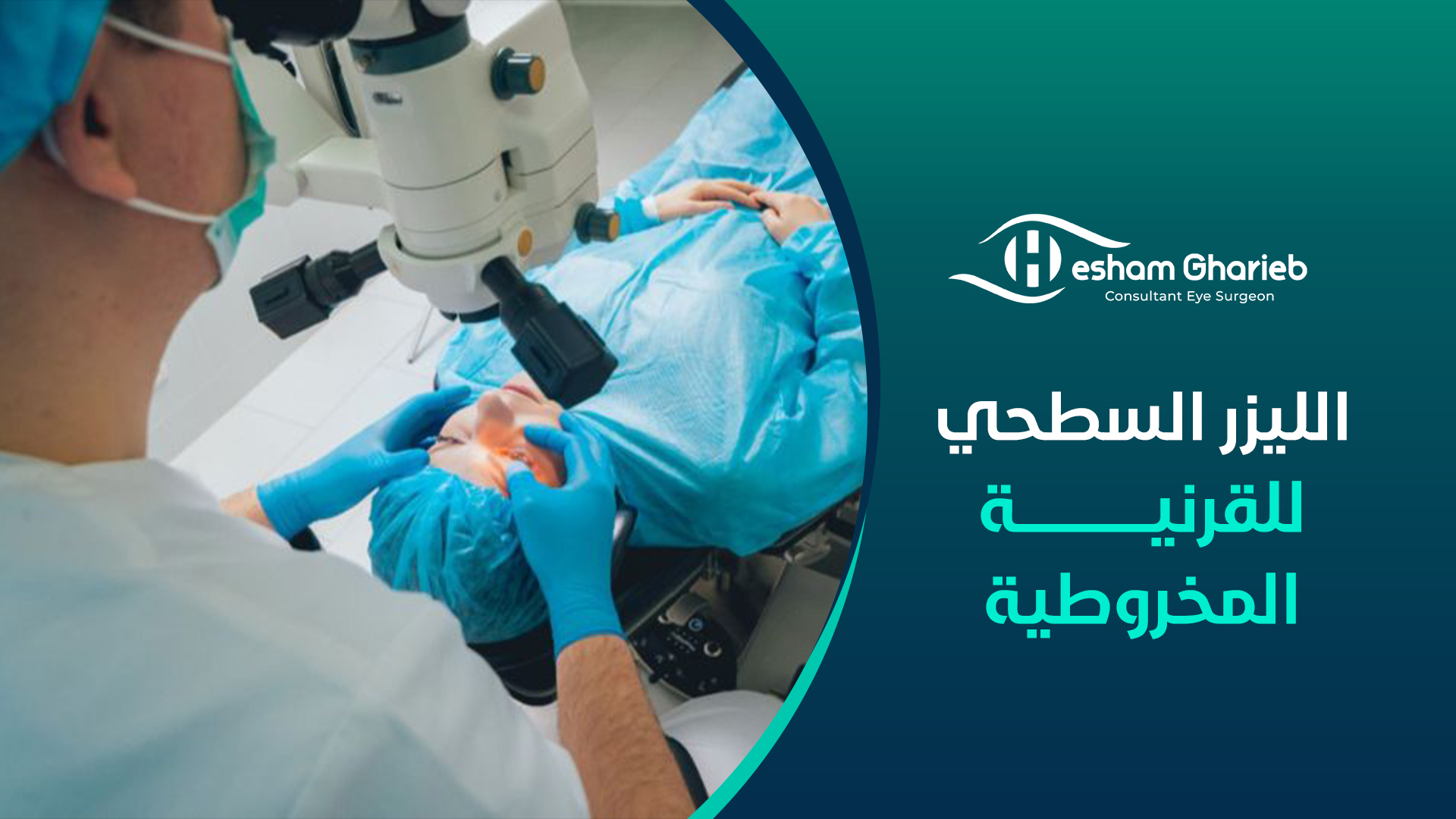 الليزر السطحي للقرنية المخروطية