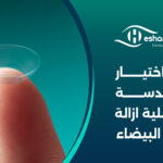كيفية اختيار نوع العدسة بعد عملية ازالة المياه البيضاء