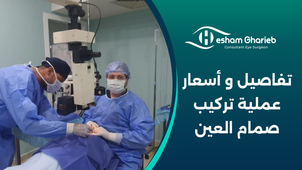 تفاصيل و أسعار عملية تركيب صمام العين
