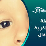 تكلفة زراعة القرنية للأطفال – كم سعر عملية زراعة القرنية للأطفال