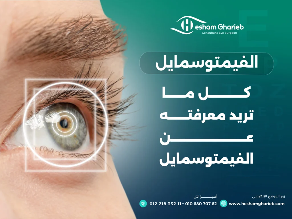 كل ما تريد معرفته عن الفيمتو سمايل