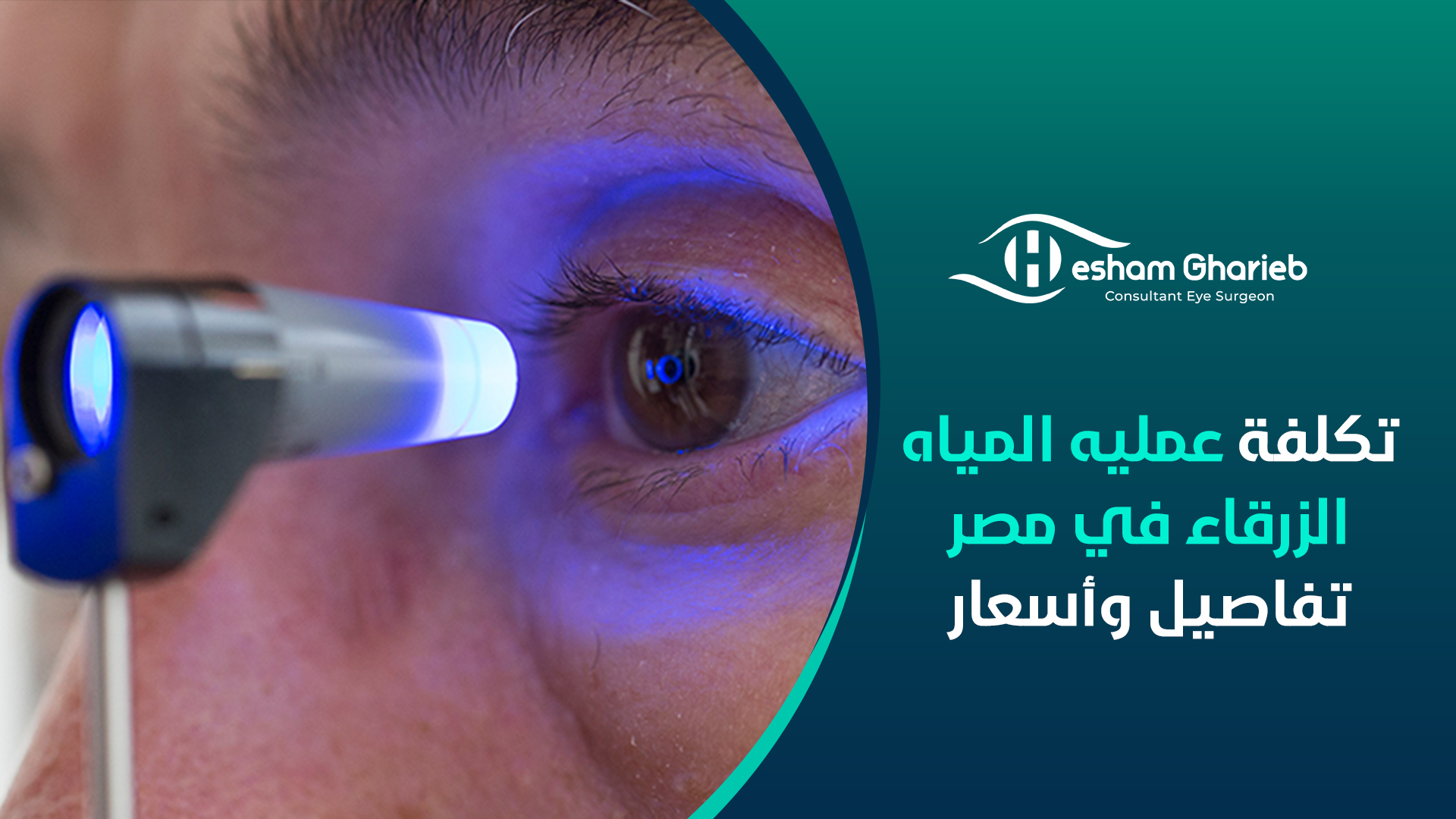 تكلفة عمليه المياه الزرقاء في مصر - تفاصيل وأسعار تكلفة عمليه المياه الزرقاء في مصر