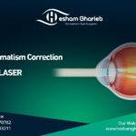 Astigmatism Correction with LASER: 3 Path to Better Vision
