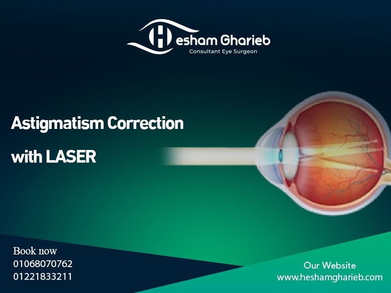 Astigmatism Correction with LASER