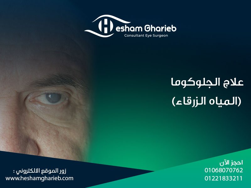 علاج الجلوكوما (المياه الزرقاء) في مصر: الأعراض، الأسباب، وأحدث طرق العلاج 2025