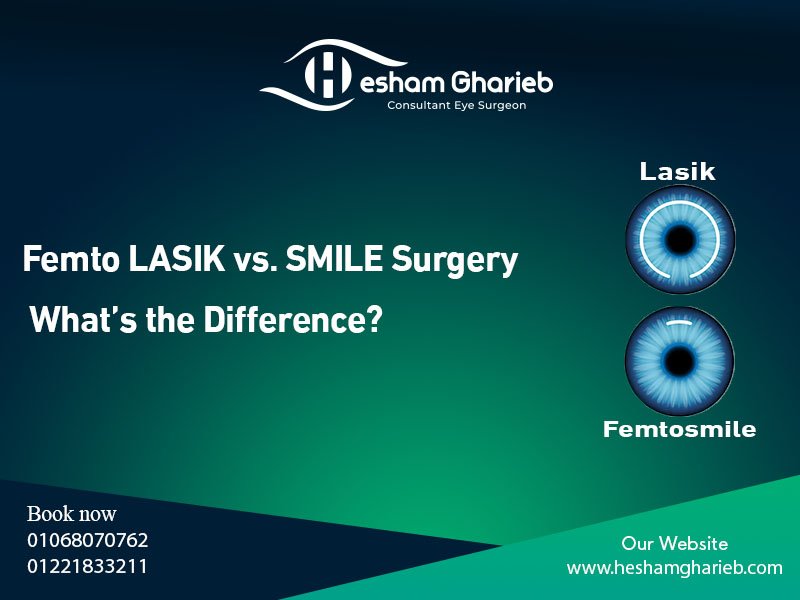 Femto LASIK vs. SMILE Surgery in Egypt