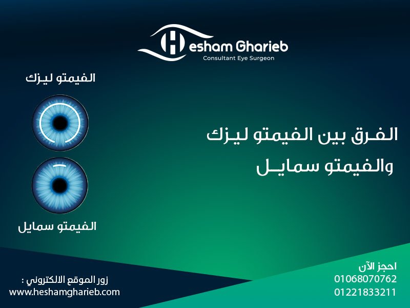 الفرق بين الفيمتو ليزك والفيمتو سمايل