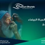 علاج المياه البيضاء بالليزر: استعادة الرؤية باستخدام أحدث تقنيات الطب