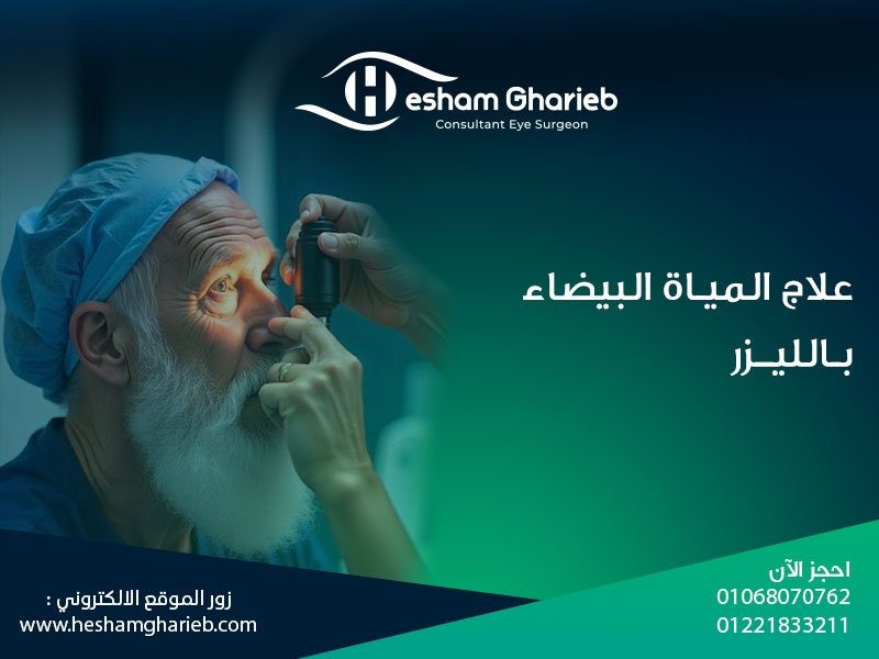 علاج المياه البيضاء بالليزر: استعادة الرؤية باستخدام أحدث تقنيات الطب