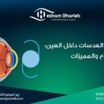 زراعة العدسات داخل العين: الأنواع والفوائد لتصحيح النظر بدون ليزك في مصر