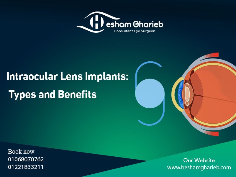 Intraocular Lens Implants