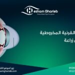 علاج القرنية المخروطية بدون زراعة: 3 خيارات آمنة وفعالة لراحة نظرك