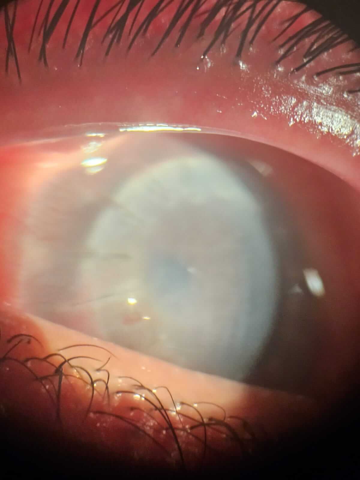 After image